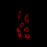ACOT12 Rabbit Polyclonal Antibody