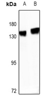 R Cadherin Rabbit Polyclonal Antibody