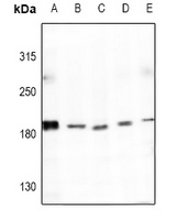 Collagen 4 alpha 4 Antibody