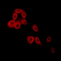 Collagen 5 alpha 2 Antibody