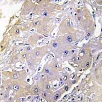 TNFAIP2 Antibody