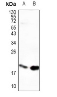 PDE6G Rabbit Polyclonal Antibody