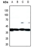MKK1/2 Antibody