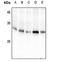 14-3-3 sigma (Phospho-S186) Rabbit Polyclonal Antibody