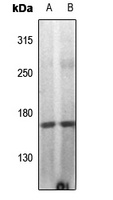 DAP Kinase 1 (Phospho-S308) Rabbit Polyclonal Antibody