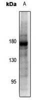 PDGFR beta (Phospho-Y857) Rabbit Polyclonal Antibody