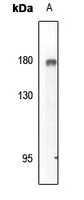 EGFR (Phospho-Y869) Rabbit Polyclonal Antibody