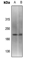Topoisomerase 2 alpha (Phospho-S1213) Rabbit Polyclonal Antibody