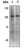 MDM2 (Phospho-S186/S188) Rabbit Polyclonal Antibody
