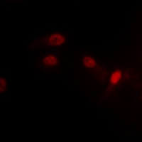 MDM2 (Phospho-S186/S188) Rabbit Polyclonal Antibody