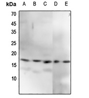 CENPA (Phospho-S7) Antibody