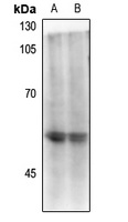 CD4 (Phospho-S433) Rabbit Polyclonal Antibody