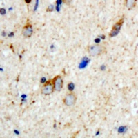 Aquaporin 2 (Phospho-S256) Rabbit Polyclonal Antibody