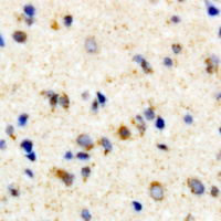 Rhodopsin (Phospho-S334) Rabbit Polyclonal Antibody