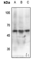 MEF2C (Phospho-S387) Rabbit Polyclonal Antibody
