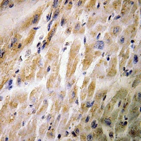 MEF2C (Phospho-S387) Rabbit Polyclonal Antibody