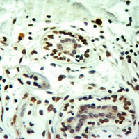 Histone H3 (MonoMethyl-R8) Rabbit Polyclonal Antibody
