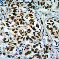 Histone H3 (TriMethyl-K4) Antibody