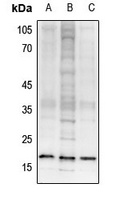 Histone H3 (TriMethyl-K27) Antibody