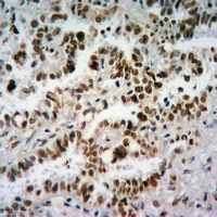 Histone H3 (TriMethyl-K27) Antibody