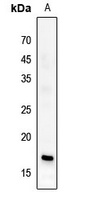 Histone H3 (Butyryl-K23) Rabbit Polyclonal Antibody
