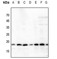Histone H3 (Acetyl-K64) Rabbit Polyclonal Antibody