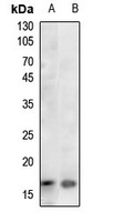 Histone H3 (Acetyl-K36) Antibody