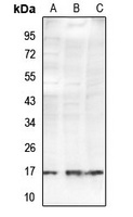 Histone H2B (Acetyl-K34) Rabbit Polyclonal Antibody