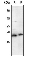 Histone H3 (Acetyl-K79) Rabbit Polyclonal Antibody