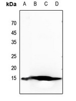Histone H2B (Acetyl-K20) Rabbit Polyclonal Antibody
