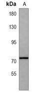 CAPN6 Mouse Monoclonal Antibody