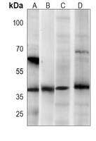 AMPK beta 1 Mouse Monoclonal Antibody