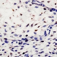 SUFU Mouse Monoclonal Antibody
