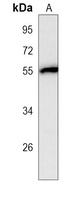 NUP50 Mouse Monoclonal Antibody