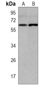GLS2 Mouse Monoclonal Antibody