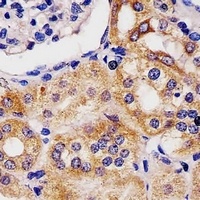 GLS2 Mouse Monoclonal Antibody