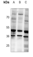 MBD2 Mouse Monoclonal Antibody