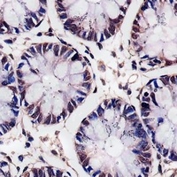 MBD2 Mouse Monoclonal Antibody