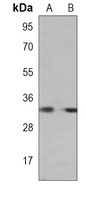 RAB20 Mouse Monoclonal Antibody