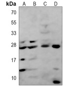 FGFR1OP2 Mouse Monoclonal Antibody