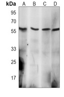 EIF2B3 Mouse Monoclonal Antibody