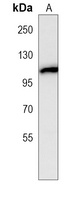 CYLD Mouse Monoclonal Antibody