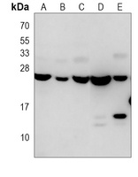 RAB18 Mouse Monoclonal Antibody