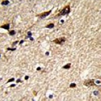Beta1-tubulin Mouse Monoclonal Antibody