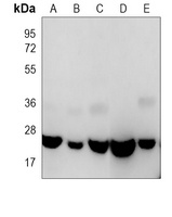 RAB1B Mouse Monoclonal Antibody