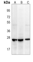 RAB1B Mouse Monoclonal Antibody