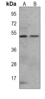 Makorin-2 Mouse Monoclonal Antibody
