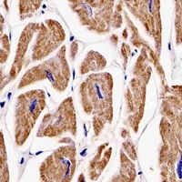 Makorin-2 Mouse Monoclonal Antibody
