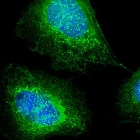 Makorin-2 Mouse Monoclonal Antibody