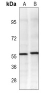 PINK1 Mouse Monoclonal Antibody